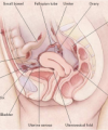 Locations of endometriosis