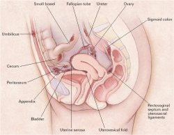 Endometriosis: how does it happen?