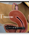 Endo-Vid-Progestins-3D